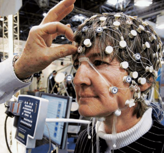 A woman wears an EEG sensor net that aids in epilepsy analysis.