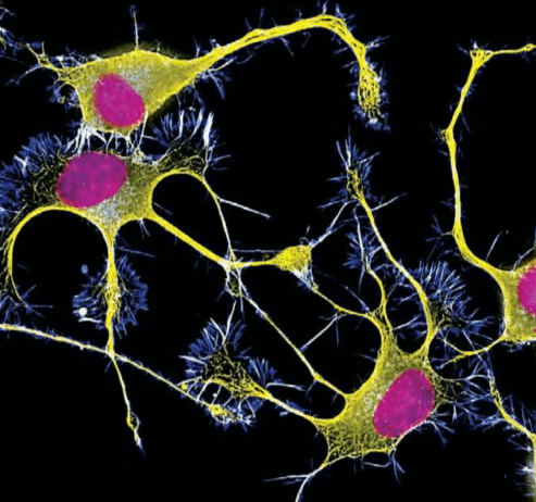 Precursors to axons and dendrites, in yellow and blue, respond to nerve growth stimulation.